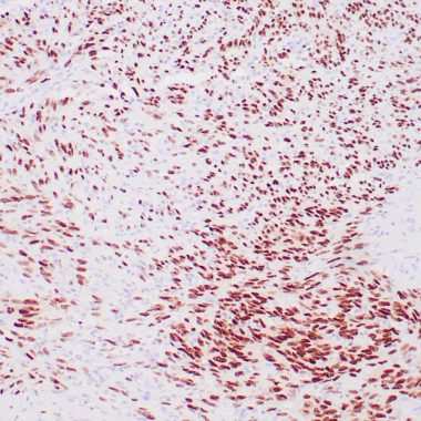 Anti-SOX10 antibody ZM10 IHC antibody paraffin tissue