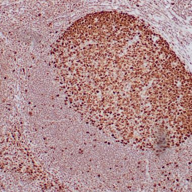 Anti-PCNA antibody ZR378 IHC antibody paraffin tissue