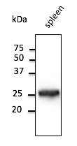 Anti-RAB5A antibody