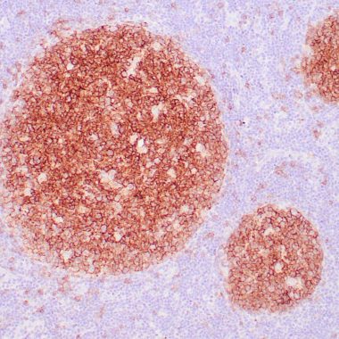 Anti-Recombinant-MS4A1 antibody L26 IHC antibody paraffin tissue