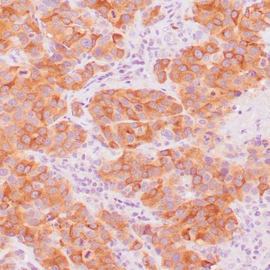 Anti-MLANA antibody A103 IHC antibody paraffin tissue