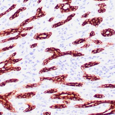 Anti-Cytokeratin CAM 5.2 antibody CAM5.2 IHC antibody paraffin tissue