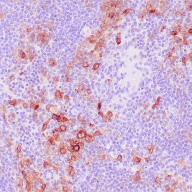 Anti-CD30 antibody Ber-H2 IHC antibody paraffin tissue