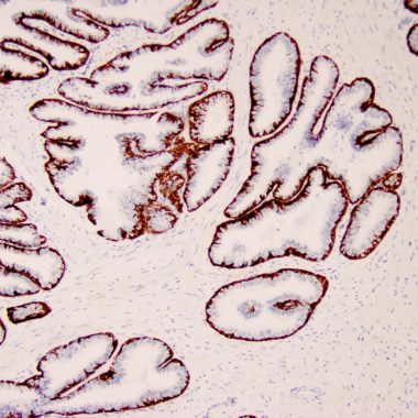 Anti-Keratin 5/6 antibody D5-16B4 IHC antibody paraffin tissue