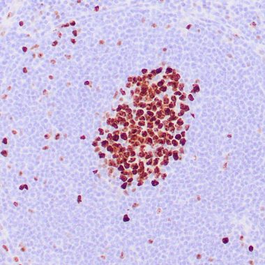 Anti-MKI67 antibody MIB-1 IHC human tonsil