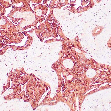 Anti-Napsin A antibody ZM11 IHC antibody paraffin tissue