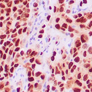 Anti-TTF-1/NKX2.1 antibody ZR176 IHC antibody paraffin tissue