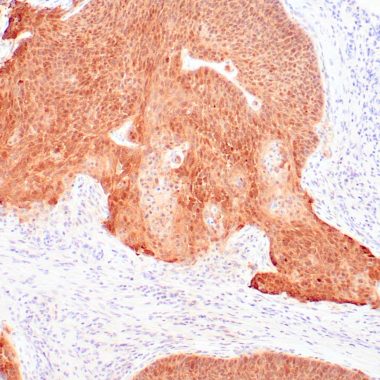 Anti-P16INK4a antibody G175-405 IHC antibody paraffin tissue