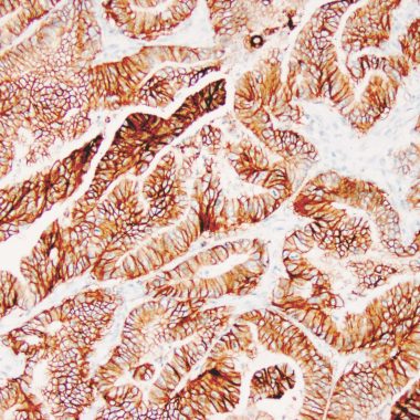 Anti-EPCAM antibody Ber-EP4 IHC antibody paraffin tissue