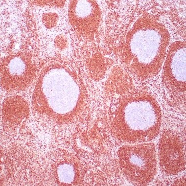 Anti-BCL2 antibody 124 IHC antibody paraffin tissue