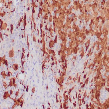 Anti-S-100 antibody 4C4.9 IHC antibody paraffin tissue
