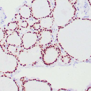 Anti-PAX8 antibody ZR1 IHC antibody paraffin tissue
