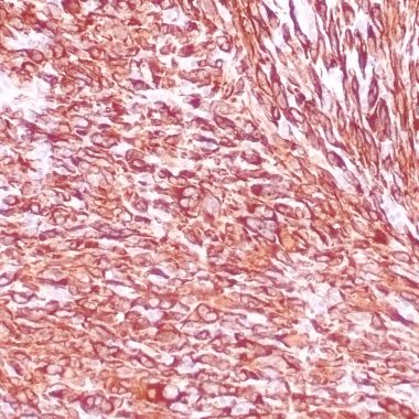 Anti-Desmin antibody ZR240 IHC antibody paraffin tissue