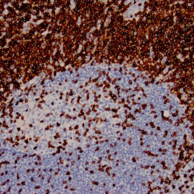 Anti-CD3 antibody ZM45 IHC antibody paraffin tissue