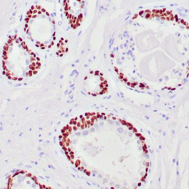 Anti-TP63 antibody 4A4 IHC antibody paraffin tissue