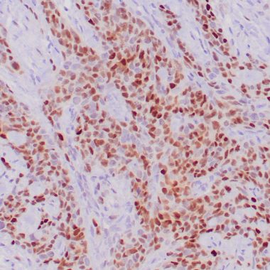 Anti-p21WAF1 antibody ZR288 IHC antibody paraffin tissue
