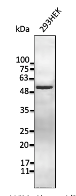 Anti-Vimentin antibody western blot STJ140133