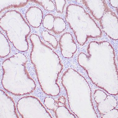 Anti-CDX2 antibody ZR215 IHC antibody paraffin tissue