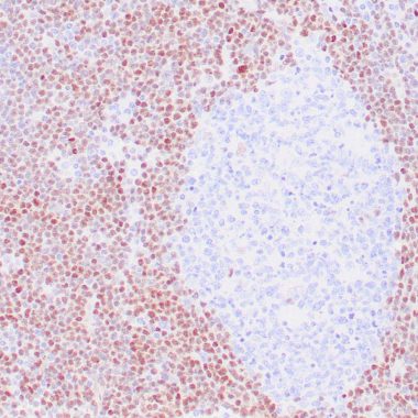 Anti-Cyclin D1 antibody ZR197 IHC antibody paraffin tissue