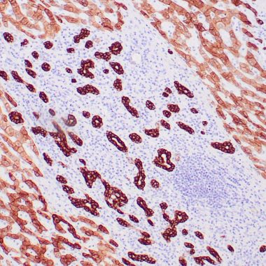 Anti-Pan-Cytokeratin antibody OSCAR IHC antibody paraffin tissue