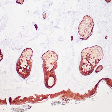 Anti-Keratin HMW antibody 34 Beta E12 IHC antibody paraffin tissue