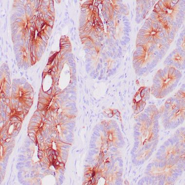 Anti-KRT20 antibody Ks20.8 IHC antibody paraffin tissue