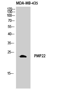 Anti-PMP22 (Rabbit Polyclonal) for WB, IHC, IF & ELISA | Human, Mouse & Rat