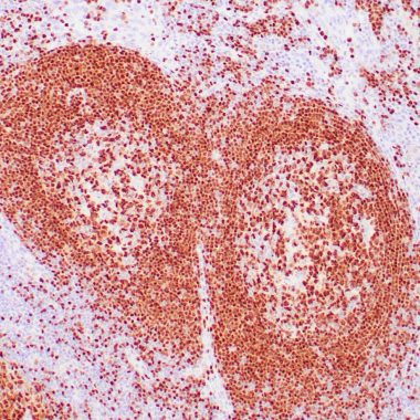 Anti-Recombinant-PAX-5 antibody IHC human lymph node