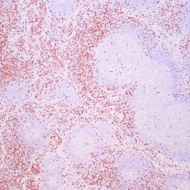 Anti-Recombinant-CD8 antibody IHC human tonsil