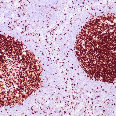 Anti-Recombinant-Ki-67 antibody IHC human lymph node