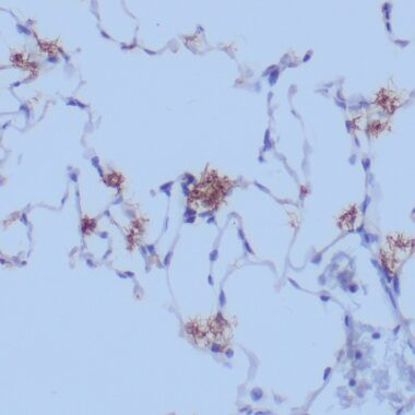 Anti-Treponema Pallidum antibody | Rabbit Polyclonal [Polyclonal] | IHC-P