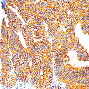 Anti-Recombinant-beta Catenin antibody