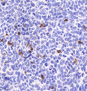 Anti-Recombinant-CD4 antibody