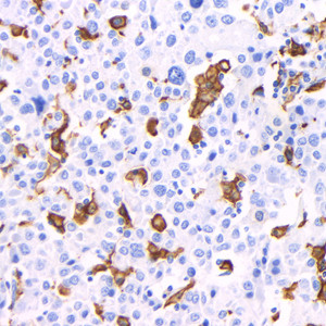 Anti-Recombinant-Iba1 antibody