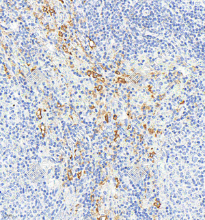 Anti-Recombinant-CD163 antibody