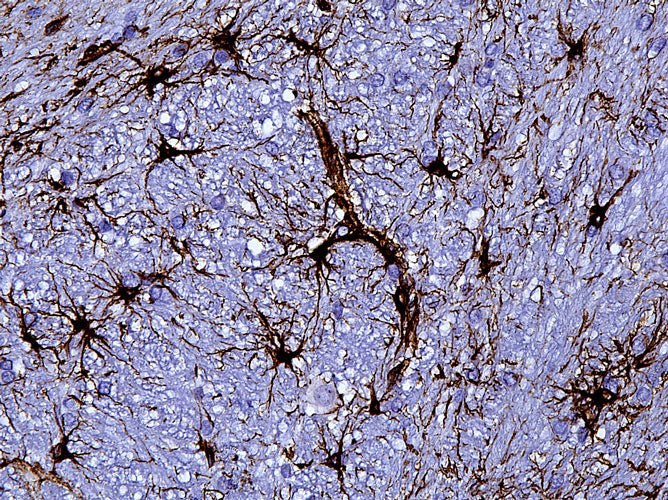 Anti-Recombinant-GFAP antibody IHC rat cerebellum astrocytes