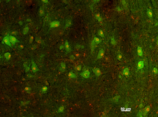 Anti-Recombinant-Tyrosine Hydroxylase antibody IHC human midbrain dopamine neurons