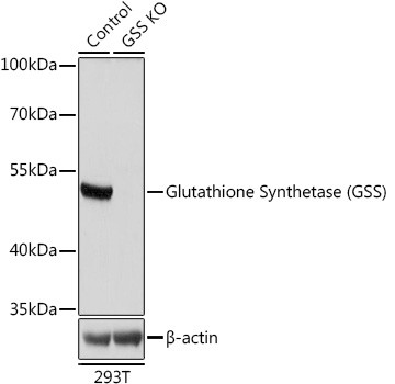 Anti-GSS antibody (373-474) (STJ116746)