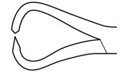 Product Spectrum Bone Reduction Forcep, 3.75in (9.5cm), Speedlock, Step-Pointed Tips | SAH.35-1156 Image