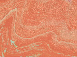CORPUSCLES