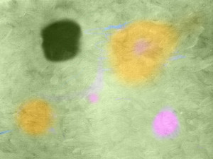 Abstract XIX