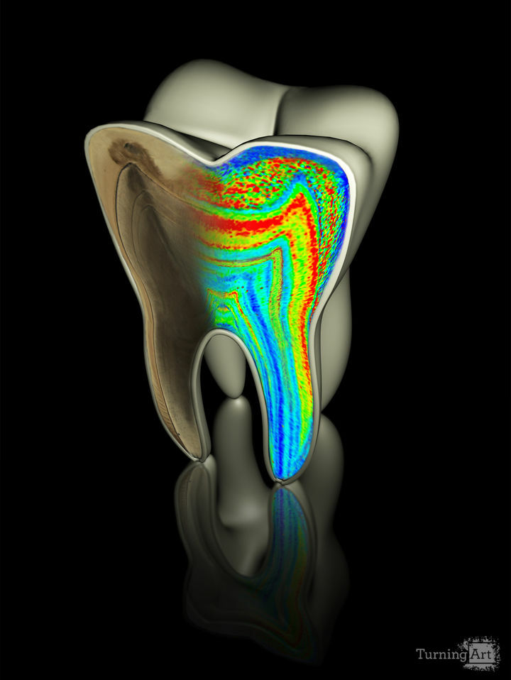 Icahn School of Medicine, Mt. Sinai
