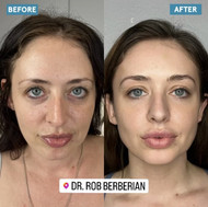 Celebrity Facial Sculpting: Unveiling the Transformative Power of Cosmetic Treatments and Fillers Celebrity Facial Sculpting: Unveiling the Transformative Power of Cosmetic Treatments and Fillers
