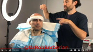 Can a 4000 Graft FUE Hair Transplant Be Done in One Day? Watch Below! Can a 4000 Graft FUE Hair Transplant Be Done in One Day? Watch Below!