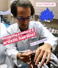 Best FUE Hair Transplant Surgery in Los Angeles by Celebrity Surgeon Dr. Rob Berberian! Best FUE Hair Transplant Surgery in Los Angeles by Celebrity Surgeon Dr. Rob Berberian!