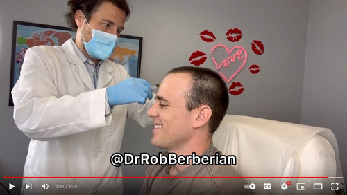 Exosome Hair Restoration Newport Beach Orange County Dr. Rob Berberian