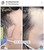 Non-Surgical Hair Loss Solutions for Men by Dr. Rob Berberian  Non-Surgical Hair Loss Solutions for Men by Dr. Rob Berberian