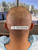 Trypophobia Fade - Dr. Rob Berberian - Los Angeles & Newport Beach - FUE Hair Transplant Trypophobia Fade - Dr. Rob Berberian - Los Angeles & Newport Beach - FUE Hair Transplant