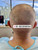 Trypophobia Fade - Dr. Rob Berberian - Los Angeles & Newport Beach - FUE Hair Transplant Trypophobia Fade - Dr. Rob Berberian - Los Angeles & Newport Beach - FUE Hair Transplant