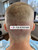 Trypophobia Fade - Dr. Rob Berberian - Los Angeles & Newport Beach - FUE Hair Transplant Trypophobia Fade - Dr. Rob Berberian - Los Angeles & Newport Beach - FUE Hair Transplant